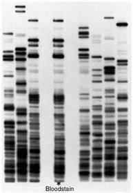 DNA Extraction and Gel Analysis - EG1003 Lab Manual